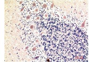 Immunohistochemical analysis of paraffin-embedded Human Brain Tissue using LC3B Mouse mAb diluted at 1:200. (LC3B antibody)