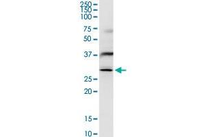 Western Blotting (WB) image for anti-N-Acetyltransferase 6 (GCN5-Related) (NAT6) (AA 1-308) antibody (ABIN949148)