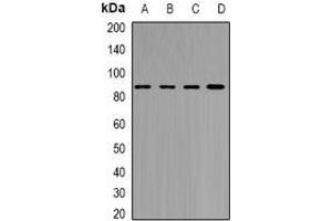 Western blot analysis of YT521-B expression in MCF7 (A), Jurkat (B), mouse brain (C), rat brain (D) whole cell lysates.