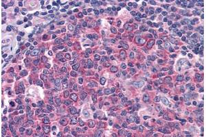 Human Tonsil: Formalin-Fixed, Paraffin-Embedded (FFPE) (IDE antibody  (AA 349-605))