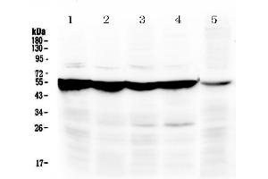 Western blot analysis of PAH using anti-PAH antibody . (Phenylalanine Hydroxylase antibody  (AA 71-208))