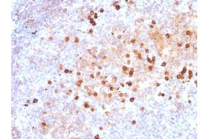 Formalin-fixed, paraffin-embedded human Tonsil stained with Purified IgM Mouse Monoclonal Antibody (IM373). (IGHM antibody)