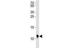 Western blot analysis of lysate from Drosophila tissue lysate using SUMO antibody diluted at 1:1000. (SUMO antibody  (AA 37-66))