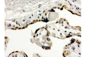 Anti- TIF1 gamma Picoband antibody, IHC(P) IHC(P): Human Placenta Tissue (TRIM33 antibody  (AA 1001-1127))