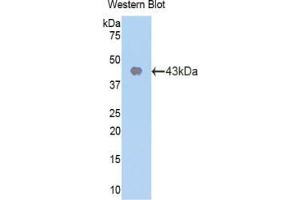 Western blot analysis of the recombinant protein. (CDK2 antibody  (AA 93-211))