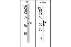 Western blot analysis of anti-AKR7A2 antibody (N-term) (ABIN391275 and ABIN2841325) in 293 cell line lysates (35 μg/lane). (AKR7A2 antibody  (N-Term))