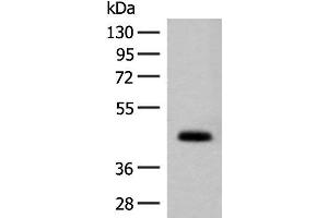 Western blot analysis of Mouse small intestines tissue lysate using GPA33 Polyclonal Antibody at dilution of 1:200