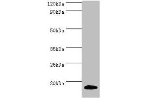 Western blot All lanes: MLANA antibody at 2 μg/mL + Mouse eye tissue Secondary Goat polyclonal to rabbit IgG at 1/10000 dilution Predicted band size: 13 kDa Observed band size: 13 kDa (MLANA antibody  (AA 48-118))