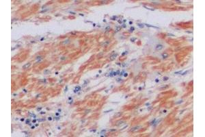 Immunohistochemistry (IHC) image for anti-Metalloproteinase Inhibitor 2 (TIMP2) (AA 27-220) antibody (ABIN7431134)