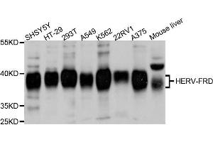 Western blot analysis of extracts of various cell lines, using ERVFRD-1 antibody. (HERV-FRD Provirus Ancestral Env Polyprotein (Herv-frd) (AA 16-250) antibody)