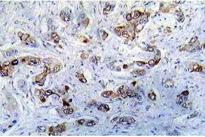 Immunohistochemistry (IHC) analyzes of CaMK2-a antibody in paraffin-embedded human A431 tissue. (CAMK2A antibody)