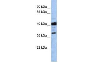 WB Suggested Anti-LRRC57 Antibody Titration: 0. (LRRC57 antibody  (Middle Region))