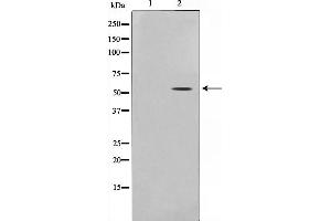 Western blot analysis of p53 phosphorylation expression in HU treated HeLa whole cell lysates,The lane on the left is treated with the antigen-specific peptide.