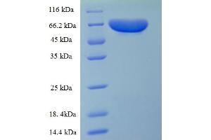 SDS-PAGE (SDS) image for Pyruvate Kinase, Liver and RBC (PKLR) (AA 1-574), (full length) protein (His tag) (ABIN5710105) (PKLR Protein (AA 1-574, full length) (His tag))
