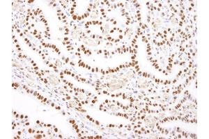 Immunohistochemistry (IHC) image for anti-Nucleolin (NCL) (C-Term) antibody (ABIN7448702) (Nucleolin antibody  (C-Term))