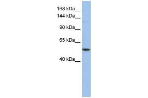 WB Suggested Anti-UBE4A  Antibody Titration: 0. (UBE4A antibody  (Middle Region))