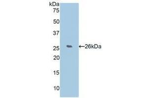 Detection of Recombinant WISP2, Human using Polyclonal Antibody to WNT1 Inducible Signaling Pathway Protein 2 (WISP2) (WISP2 antibody  (AA 24-250))