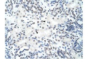 HNRPH3 antibody was used for immunohistochemistry at a concentration of 4-8 ug/ml to stain Epithelial cells of renal tubule (arrows) in Human Kidney. (HNRNPH3 antibody)