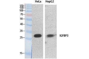 Western Blotting (WB) image for anti-Insulin-Like Growth Factor Binding Protein 3 (IGFBP3) (Internal Region) antibody (ABIN3178534) (IGFBP3 antibody  (Internal Region))