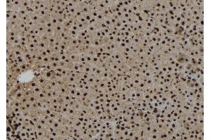 ABIN6273271 at 1/100 staining Rat liver tissue by IHC-P. (NAT10 antibody  (Internal Region))
