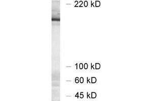 dilution 1 : 1000, sample: synaptic membrane fraction of rat brain (LP1) (UNC13A/Munc13-1 antibody  (AA 3-317))