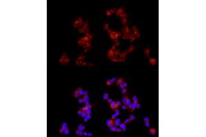 Immunofluorescence analysis of SH-SY5Y cells using G Rabbit pAb (ABIN6131686, ABIN6140882, ABIN6140883 and ABIN6214785) at dilution of 1:350 (40x lens). (GABBR1 antibody  (AA 200-460))
