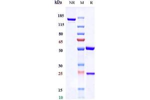 Anti-CTLA-4 / CD152 Reference Antibody (tremelimumab) on SDS-PAGE under reducing (R) condition. (Recombinant CTLA-4 (Tremelimumab Biosimilar) antibody)