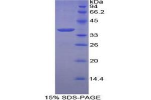 SDS-PAGE analysis of Chicken Annexin V Protein. (Annexin V Protein)
