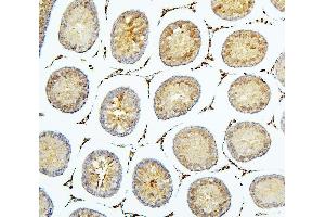 IHC analysis of BUB1B using anti-BUB1B antibody (ABIN7600962).