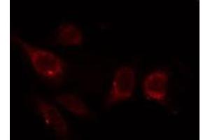 ABIN6267320 staining HepG2 by IF/ICC. (CDK1 antibody  (pTyr15))