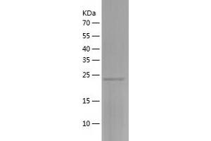 Western Blotting (WB) image for RAB3B, Member RAS Oncogene Family (RAB3B) (AA 1-219) protein (His tag) (ABIN7124756) (RAB3B Protein (AA 1-219) (His tag))