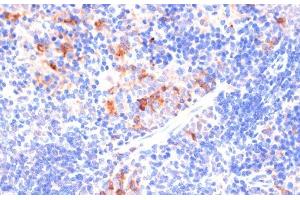 Immunohistochemistry of paraffin-embedded Mouse spleen using ARRB1 Polyclonal Antibody at dilution of 1:100 (40x lens). (beta Arrestin 1 antibody)