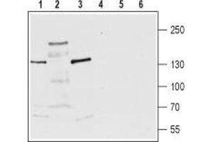 Western blot analysis of rat brain membrane (lanes 1 and 4), rat brain lysate (lanes 2 and 5) and mouse brain lysate (lanes 3 and 6): - 1-3. (TRPM3 antibody  (Extracellular))