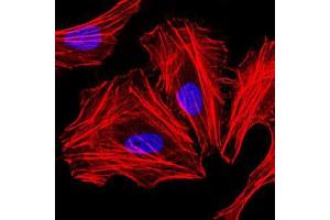 Immunofluorescence analysis of HeLa cells. (CEBPA antibody)