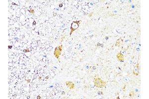 Immunohistochemistry of paraffin-embedded mouse spinal cord using TH Antibody (ABIN5974878) at dilution of 1/100 (40x lens). (TH antibody)