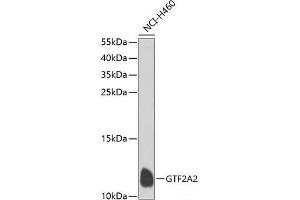 Western blot analysis of extracts of NCI-H460 cells using GTF2A2 Polyclonal Antibody at dilution of 1:1000. (GTF2A2 antibody)