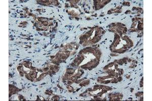Image no. 1 for anti-SKI-Like Oncogene (SKIL) (AA 307-684) antibody (ABIN1491380) (SKIL antibody  (AA 307-684))