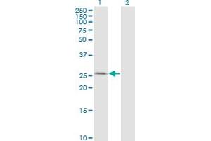 Western Blot analysis of AK3 expression in transfected 293T cell line by AK3 monoclonal antibody (M01), clone 1D2. (Adenylate Kinase 3 antibody  (AA 25-86))