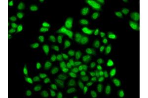 Immunofluorescence analysis of A549 cells using FBXO7 antibody. (FBXO7 antibody)