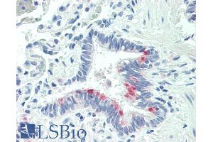 ABIN263186 (5µg/ml) staining of paraffin embedded Human Lung. (MTHFS antibody  (Internal Region))