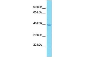 Western Blotting (WB) image for anti-GATS Protein-Like 3 (GATSL3) (C-Term) antibody (ABIN2774549) (GATSL3 antibody  (C-Term))