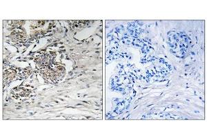 Immunohistochemistry analysis of paraffin-embedded human prostate carcinoma tissue using Claudin 7 (epitope around residue 210) antibody. (Claudin 7 antibody  (Tyr210))