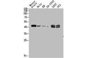 Western blot analysis of mouse-brain HELA KB SH-SY5Y 293T 3T3 lysis using MAGE-C2 antibody.