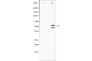Western blot analysis of SAPK/JNK phosphorylation expression in Anisomycin treated HeLa whole cell lysates,The lane on the left is treated with the antigen-specific peptide. (SAPK, JNK (pThr183) antibody)