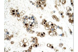 Immunohistochemistry (IHC) image for anti-UNC Homeobox (UNCX) (C-Term) antibody (ABIN2783013) (UNCX antibody  (C-Term))