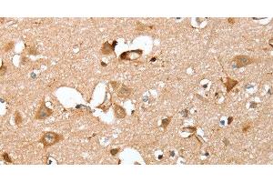 Immunohistochemistry of paraffin-embedded Human brain using CAPG Polyclonal Antibody at dilution of 1:40 (CAPG antibody)