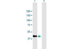 Western Blot analysis of CPB1 expression in transfected 293T cell line by CPB1 MaxPab polyclonal antibody. (CPB1 antibody  (AA 1-417))