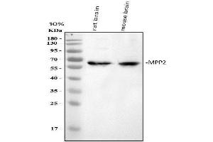 Western blot analysis of MPP2 using anti-MPP2 antibody (ABIN4886674).