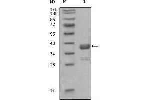 Western blot analysis using ABL1 mouse mAb against truncated GST-ABL1 recombinant protein (1). (ABL1 antibody  (AA 577-650))