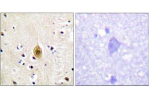Immunohistochemical staining of paraffin-embedded human brain tissue reacted with STK4/STK3 (phospho T183) polyclonal antibody  at 1:50-1:100 dilution. (STK4 antibody  (pThr183))